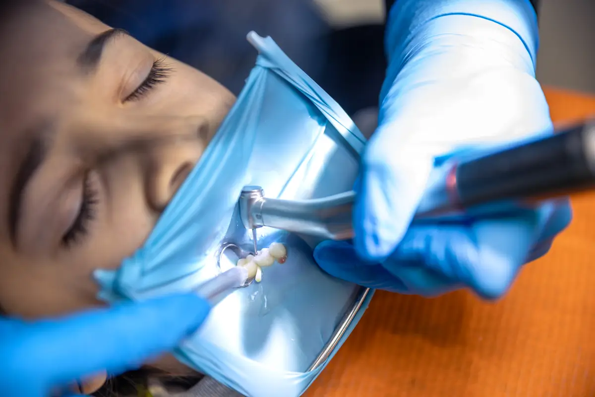 The dentist treats the childs tooth using a rubber dam Closeup of tooth treatment