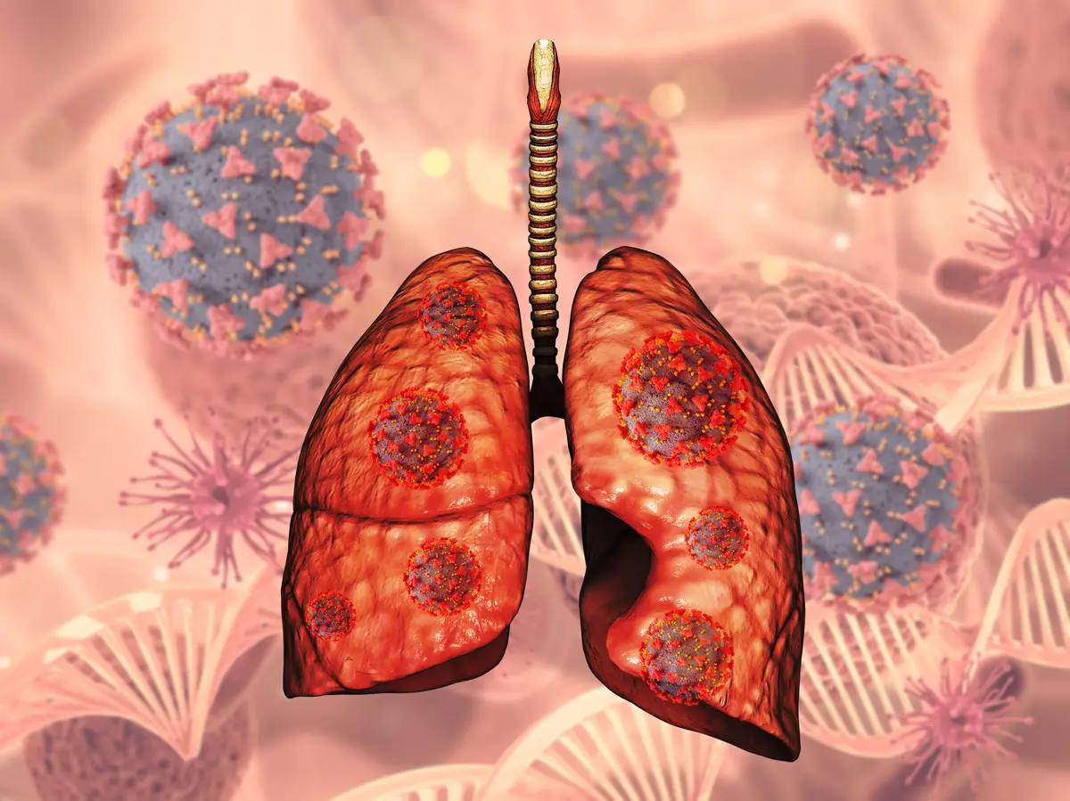 Tuberculose em HIV: Tratamento, complicações e cuidados especiais 1 3D render of a medical background with lungs and Covid 19 virus cells