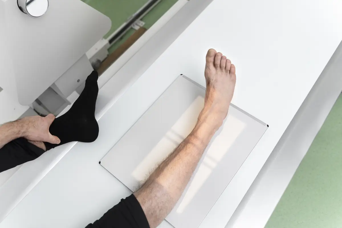 High angle patient getting leg scan