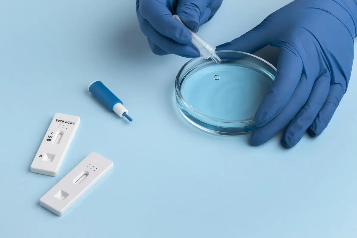 Síndrome da púrpura fulminante por Capnocytophaga canimorsus: diagnóstico e tratamento 2 Hand with protective gloves making a covid test with a petri dish