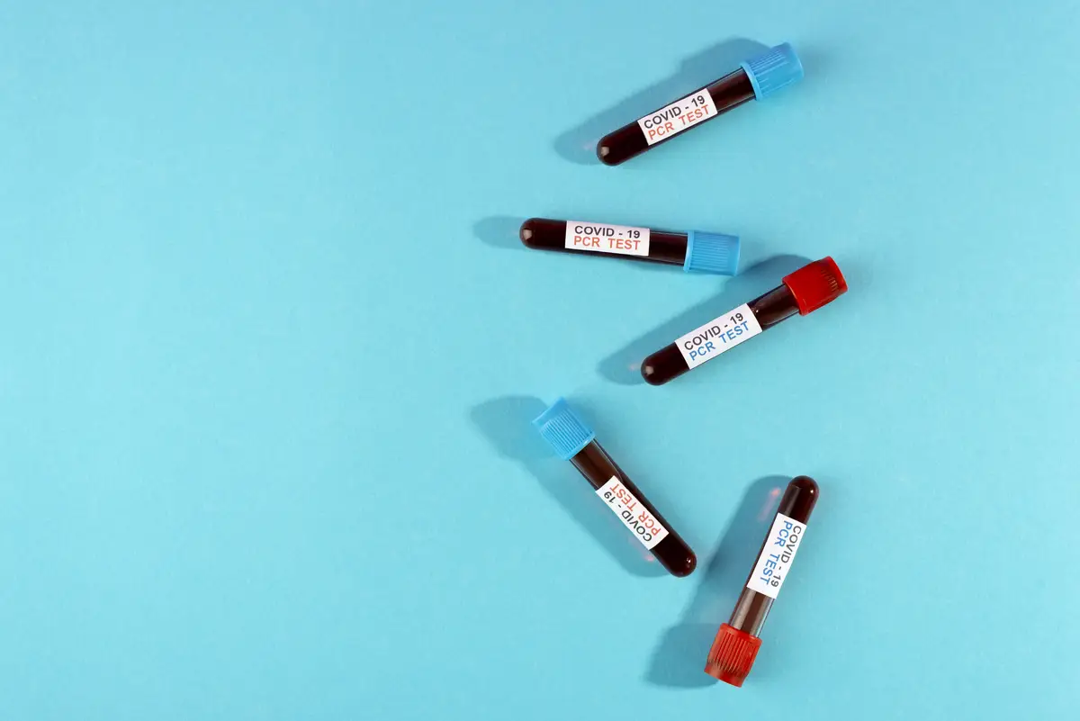 Abordagem das coinfecções e infecções oportunistas no HIV 1 Top view coronavirus pcr tests arrangement