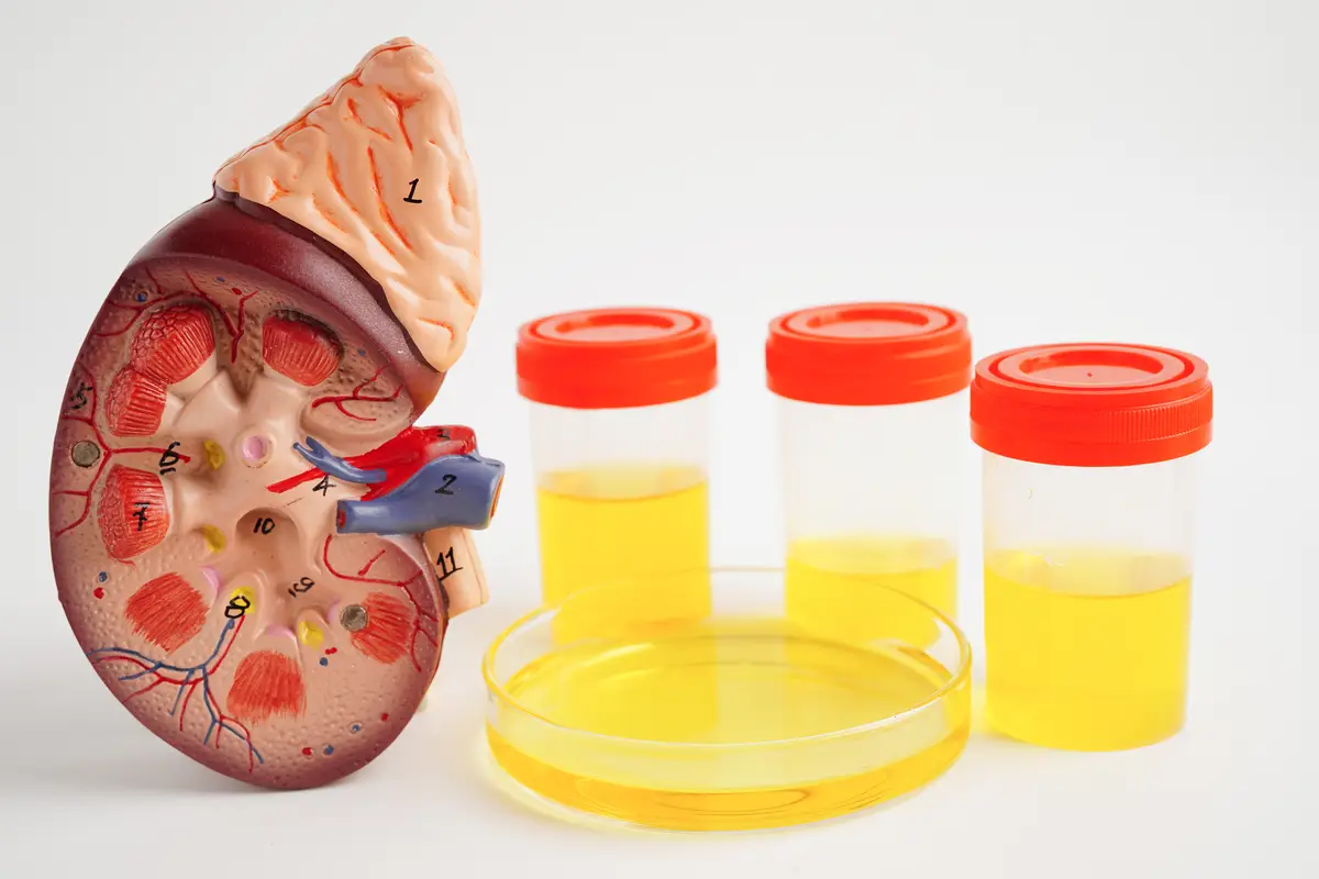 Interpretação dos testes sorológicos da hepatite B 2 Urinalysis Kidney and urine cup for check health examination in laboratory