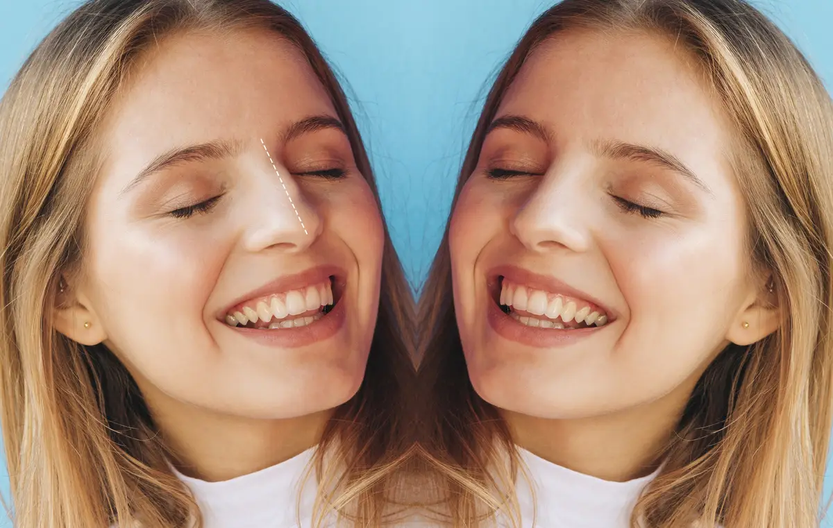 Rhinoplasty surgery concept with  woman model