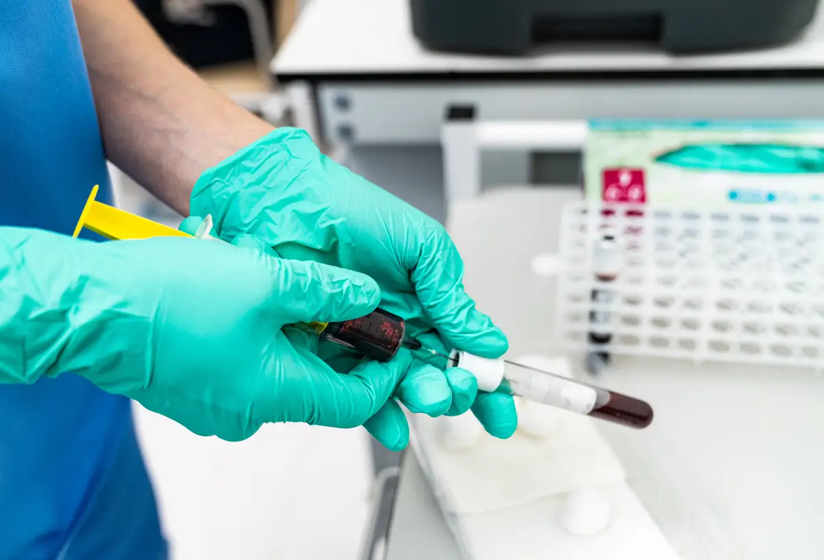 Guia prático para o manejo da bacteremia por Staphylococcus aureus 1 PlateletRich plasma preparation Centrifuge biochemistry plasma preparation