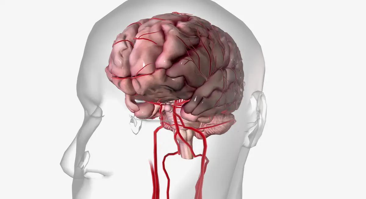 A transient ischemic attack is a mini stroke with similar symptoms to an ischemic stroke but without lasting effects