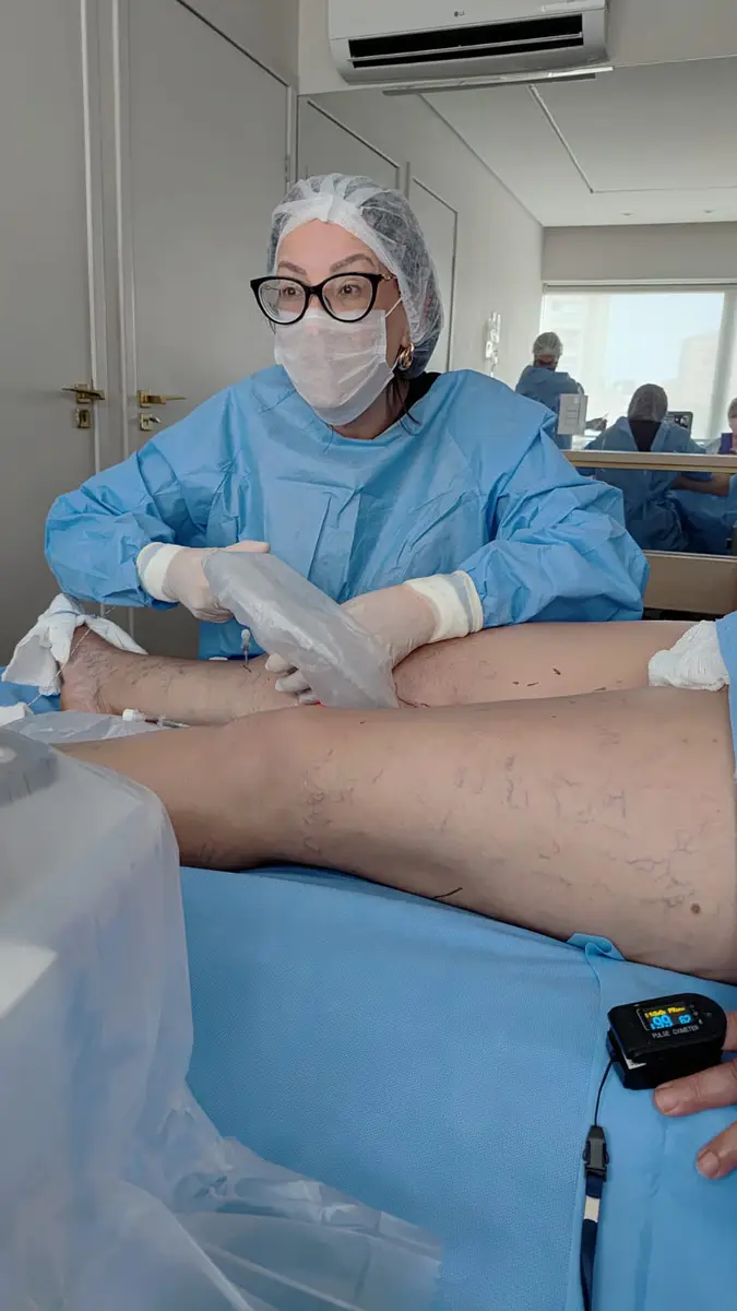 Médica com traje cirúrgico realizando procedimento vascular moderno nas pernas de um paciente
