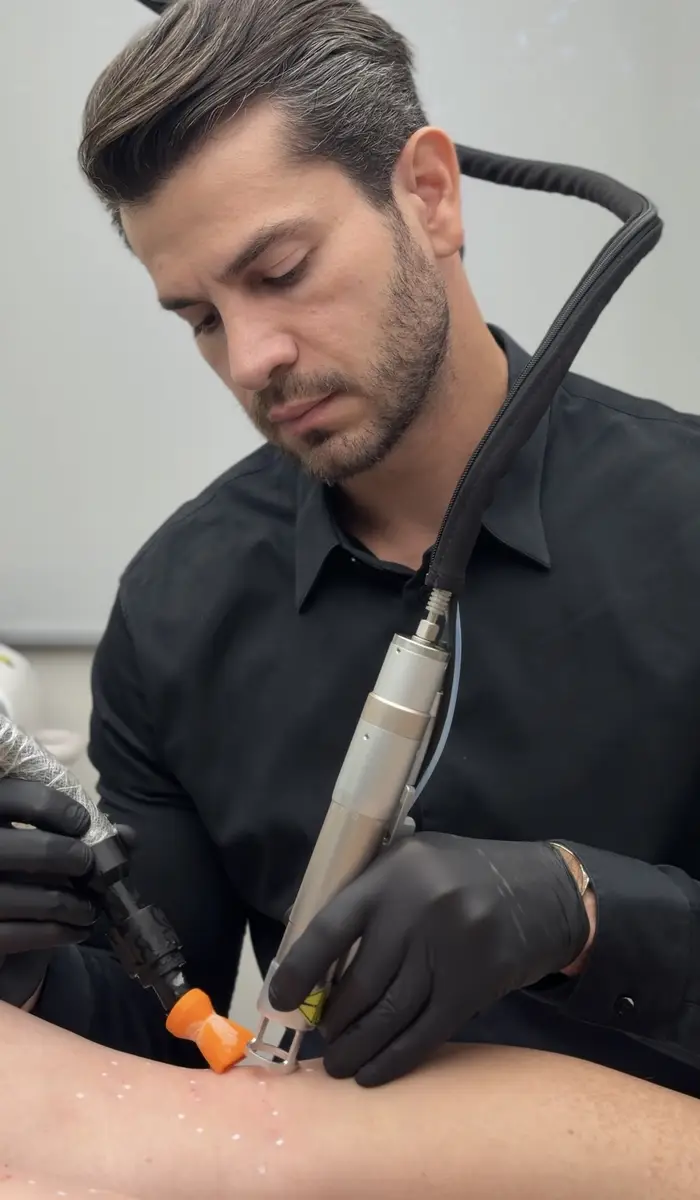 Médico realizando procedimento a laser em perna de paciente