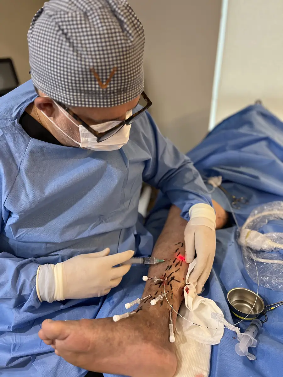 Dr. Marcelo Mandelli realizando procedimento minimamente invasivo na perna do paciente em ambiente clínico