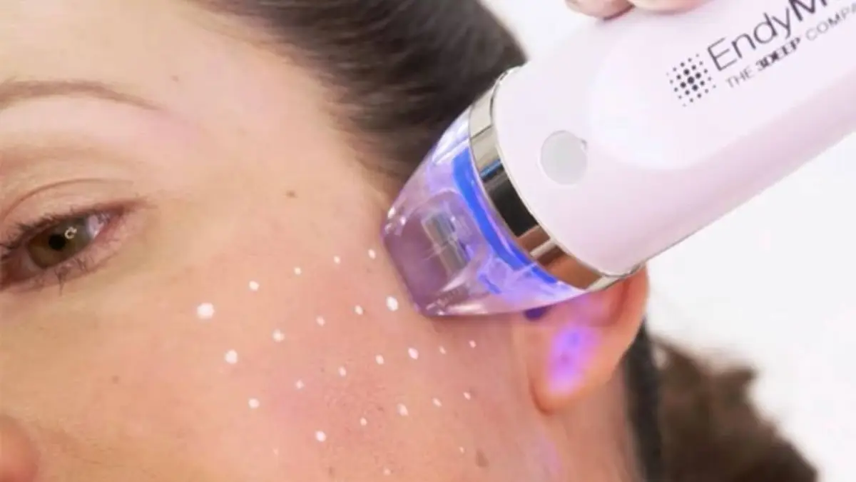 Tratamento facial com aparelho de tecnologia azul na bochecha